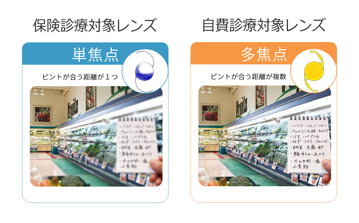 単焦点と多焦点の2種類のレンズがあります